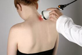 Terapia laserowa